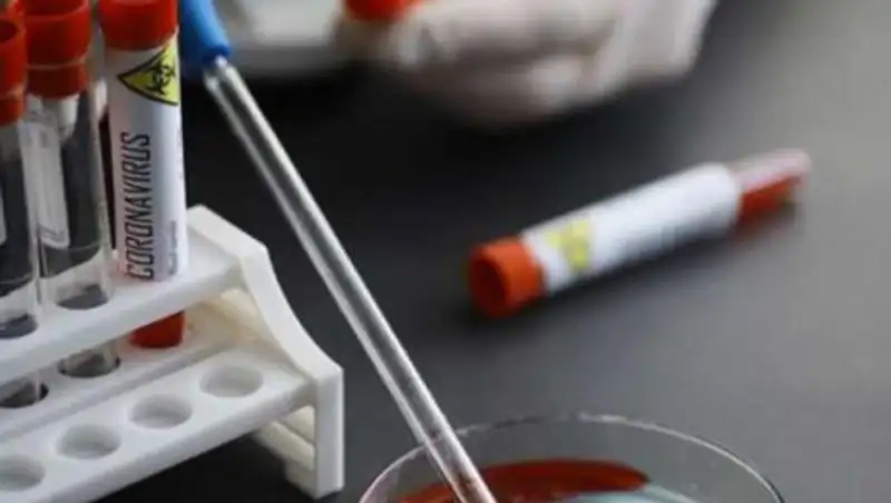 За ночь количество зараженных коронавирусом в РК достигло 670