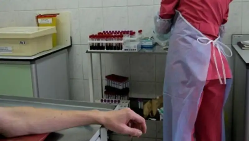 В Костанае участились случаи заболевания ВИЧ