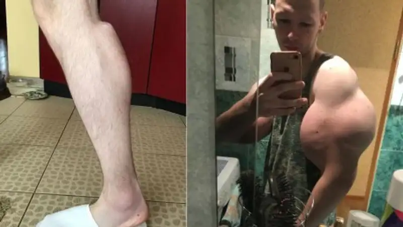 "Руки-базуки" сделал себе "икры-ракеты"