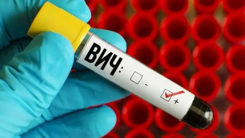 В Астане зарегистрирован 171 случай ВИЧ-инфекции