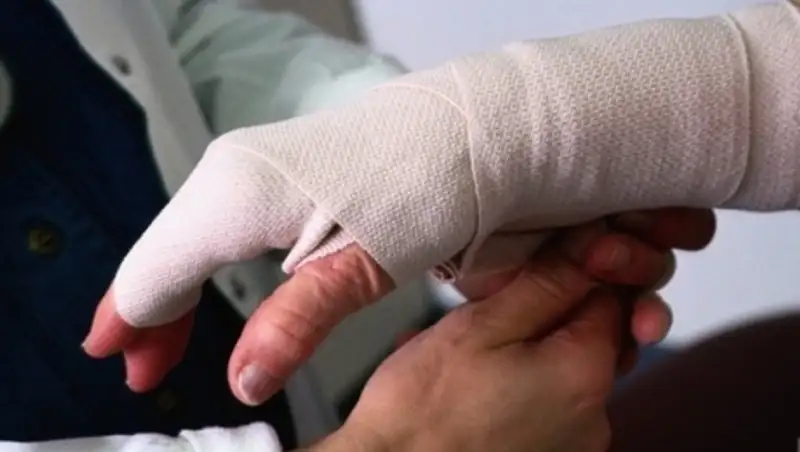 В Алматы с диагнозом обморожение с начала года госпитализированы более ста человек