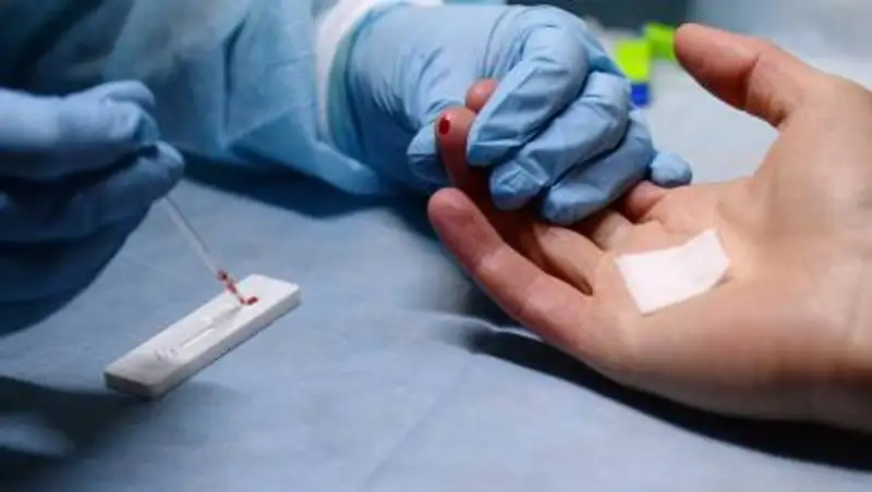 Правила расследования случаев заражения ВИЧ-инфекцией утвердили в РК