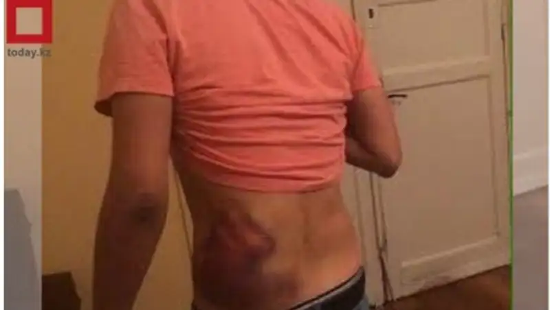 В Шымкенте бизнесмена подозревают в жестоком избиении молодого человека 