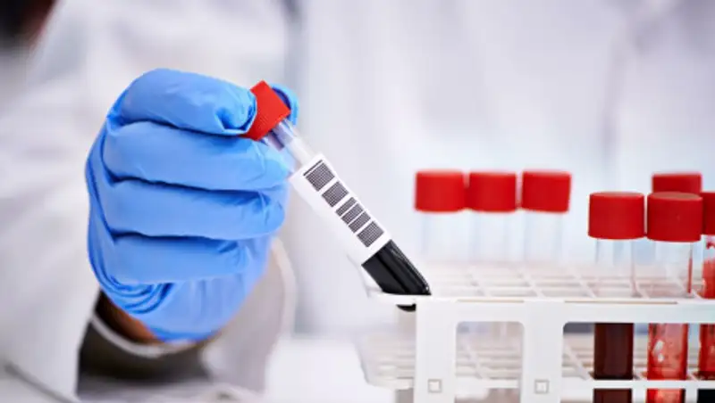 Еще 23 человека заразились коронавирусом в Алматы