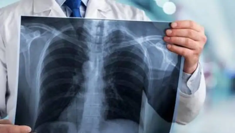 Число умерших от COVID-19 в Казахстане превысило 4300 человек