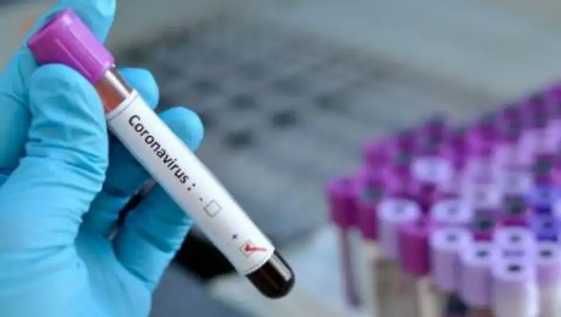 За сутки в Казахстане выявили 58 случаев заражения Covid-19