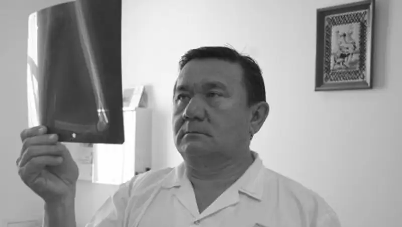 Врач: растет число детей, пострадавших после падения из окон