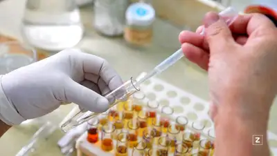 анализ, фото - Новости Zakon.kz от 13.02.2022 08:00