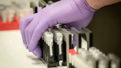 prm.ua;Минздрав РК, фото - Новости Zakon.kz от 29.03.2020 23:32