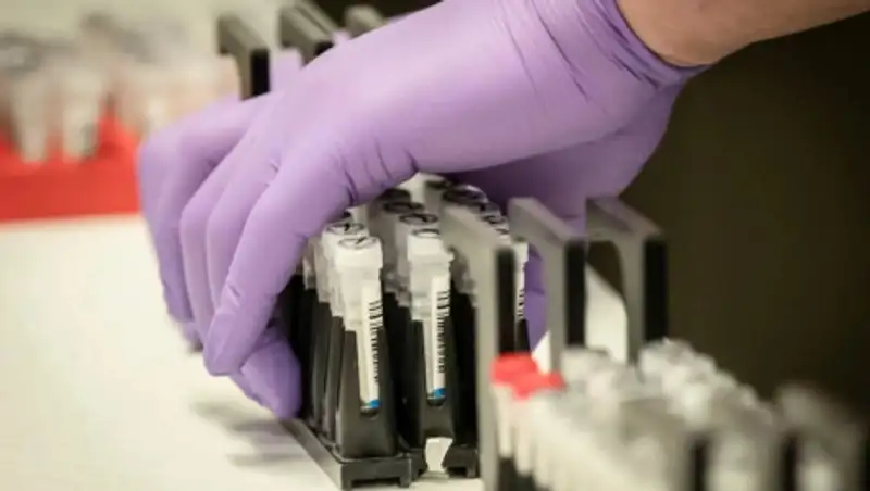 Диагноз коронавирусной инфекции подтвержден у 283 казахстанцев