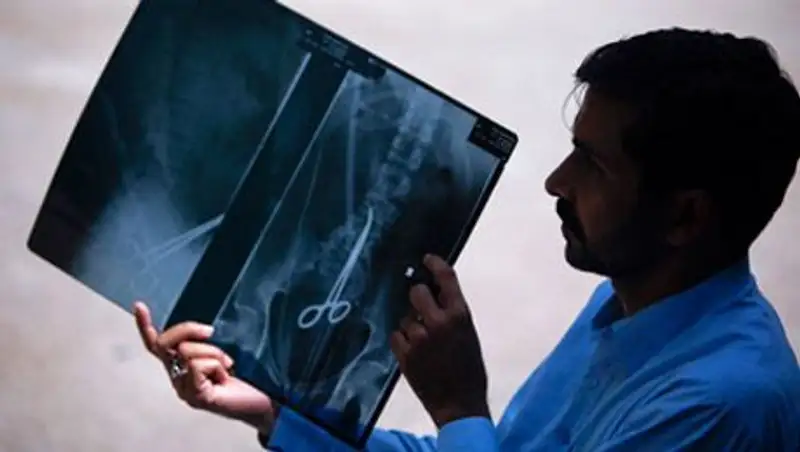 Проживший девять лет с ножницами в желудке босниец подал в суд