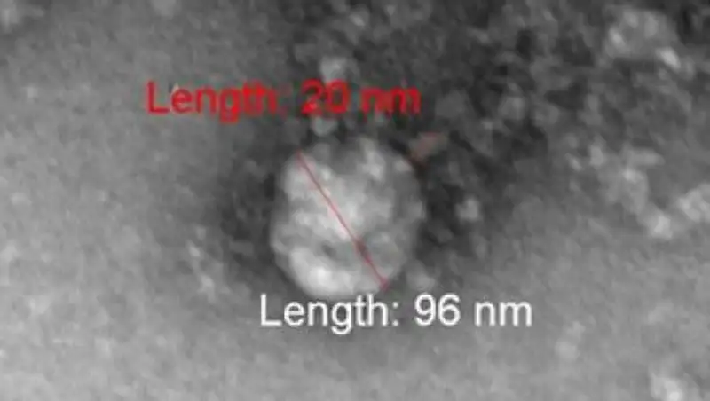 Первое фото британского штамма коронавируса показали ученые