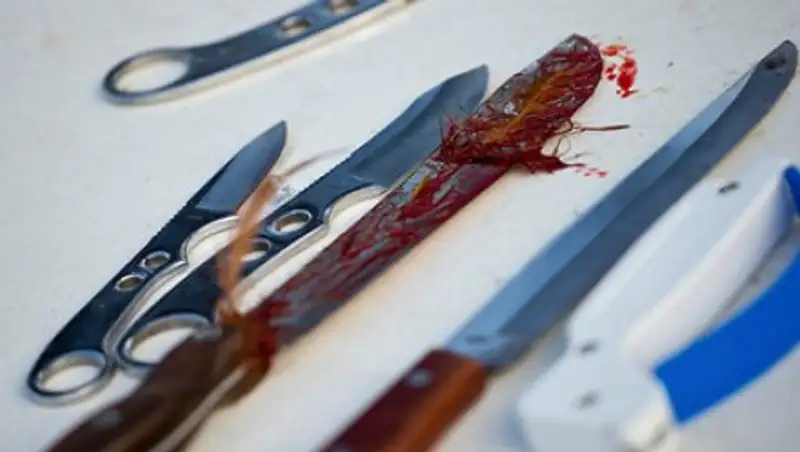 Австралиец с ножом в спине предпочел пиво поездке в больницу