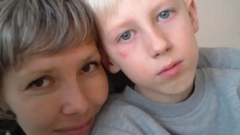 В ВКО родители обвиняют школьного слесаря в том, что он чуть не сломал нос их сыну