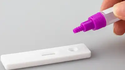 СOVID-19, фото - Новости Zakon.kz от 30.11.2022 09:28