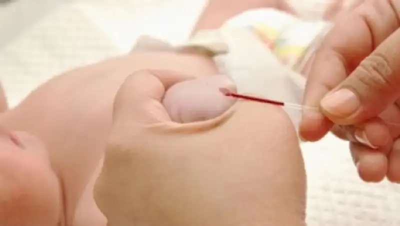 В Казахстане впервые провели лечение врожденного лейкоза