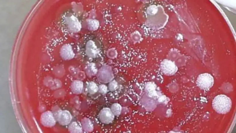 Главный ветеринарный-санитарный врач области: В Прииртышье сибирская язва не выявлена