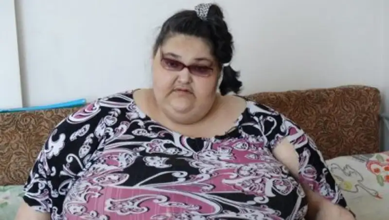 350-килограммовая жительница Костаная просит о помощи