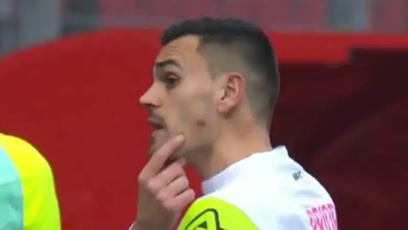 Футболист укусил соперника в лицо во время матча во Франции