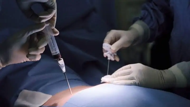 Заключенного этапировали в Астану для трансплантации костного мозга