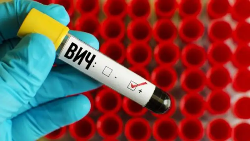 У двух школьниц в ВКО выявлен положительный ВИЧ-статус