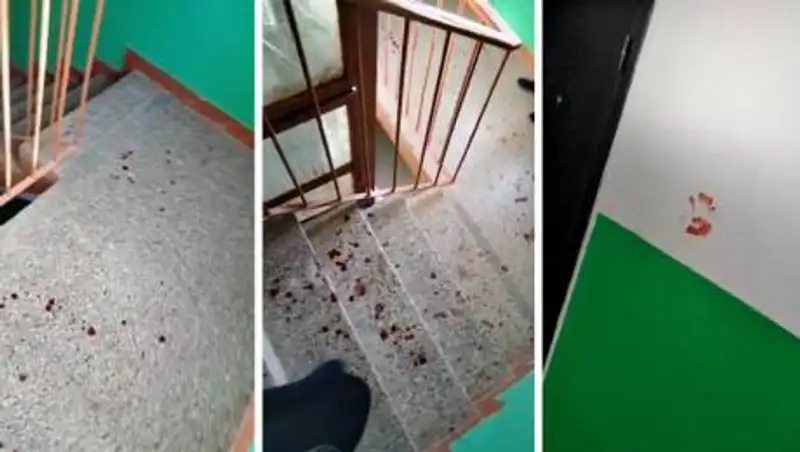 В полиции ЗКО прокомментировали рассылку об отрезанных гениталиях