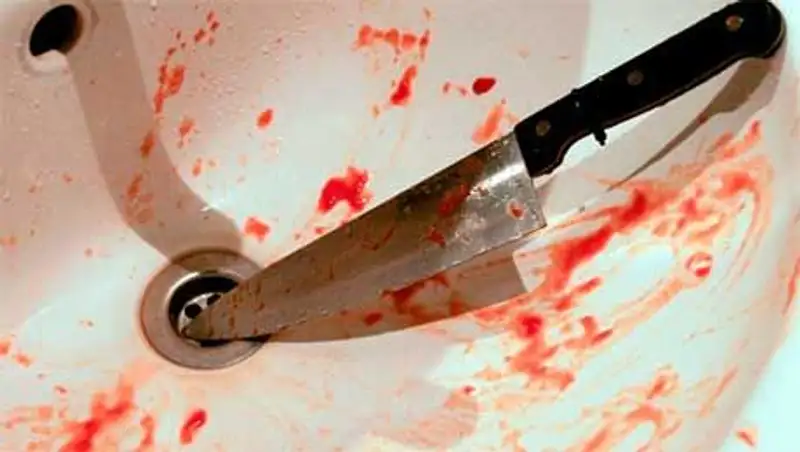 Спецпрокуроры Павлодара расследуют обращение мужчины в больницу с отрезанной кистью руки