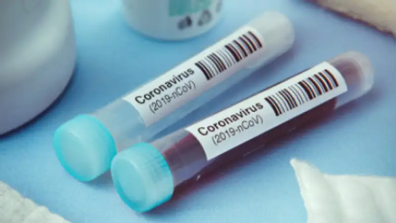 Пациентам с легкой формой COVID-19 не нужно сдавать ПЦР-тесты