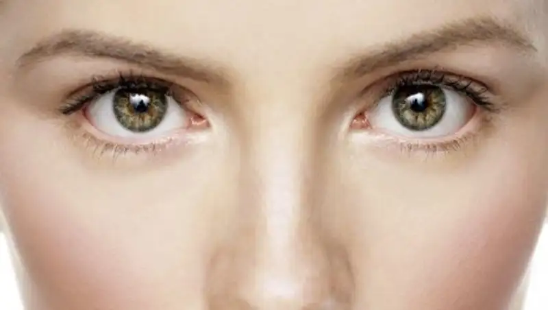 К чему приводит макулярный разрыв в глазах