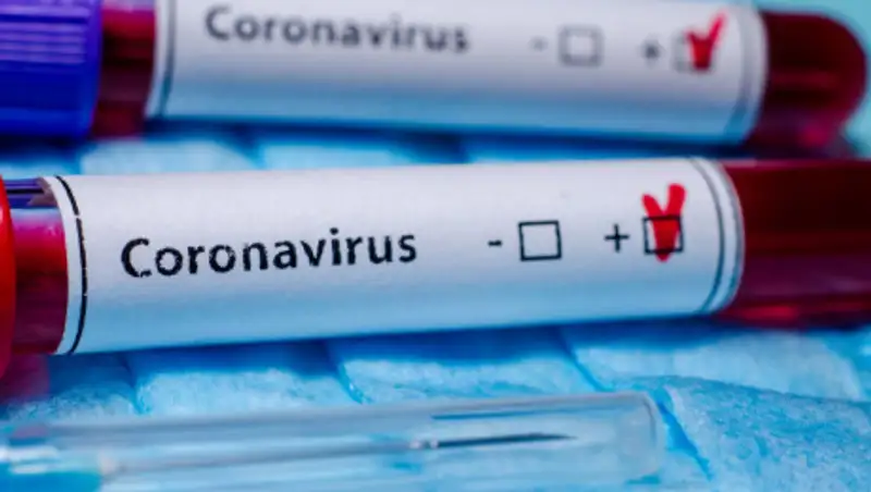 Еще 476 человек заразились коронавирусом в Казахстане