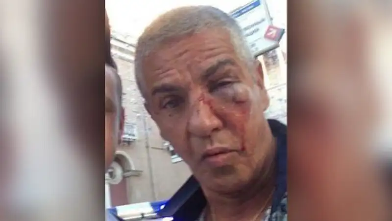 Мужчина рассказал за что избил в Москве французскую кинозвезду