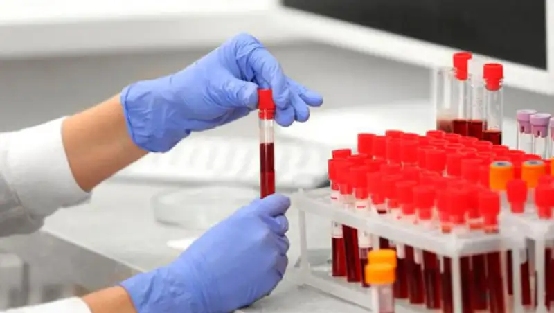 160 случаев заражения коронавирусом зарегистрировано на месторождении Тенгиз