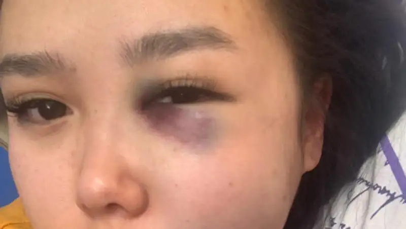 В Костанае разобрались с ситуацией по избиению девушки