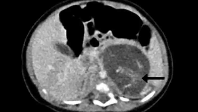 Новорожденная гонконгская девочка оказалась беременной двумя братьями