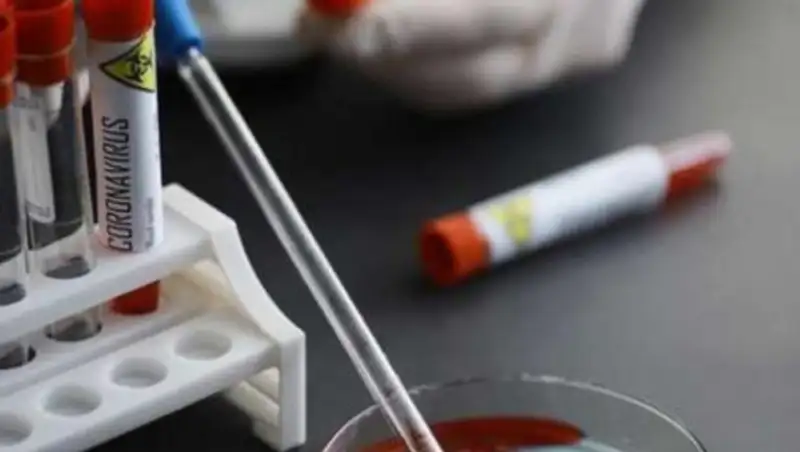 За ночь количество зараженных коронавирусом в Казахстане достигло 880