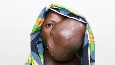 medikforum.ru, фото - Новости Zakon.kz от 09.04.2018 23:48