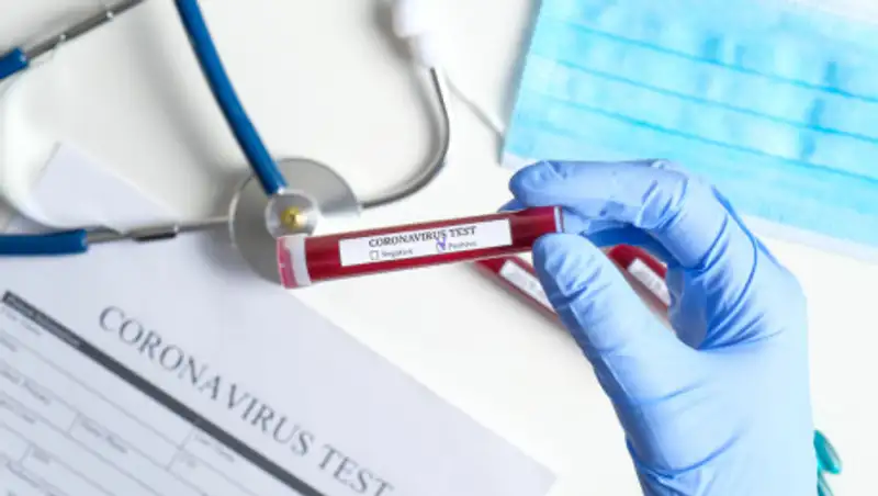 Число выявленных случаев заражения коронавирусом в Узбекистане достигло 1 758