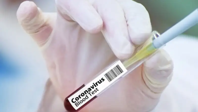 Кто может сдать тестирование методом ПЦР бесплатно