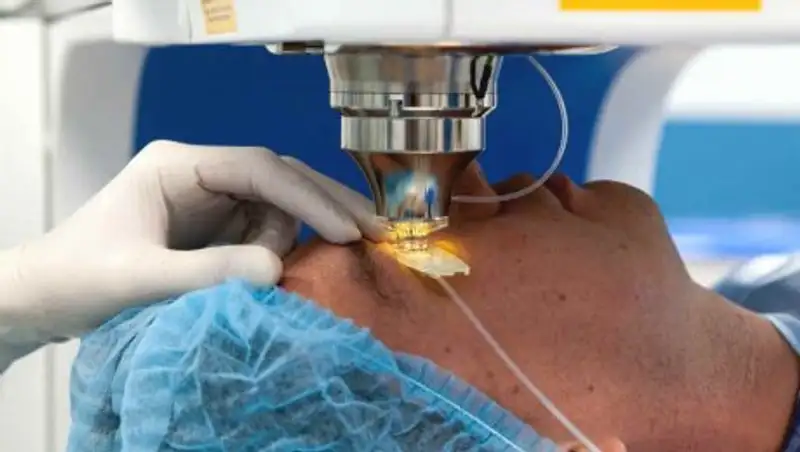 Что можно и нельзя после лазерной коррекции зрения