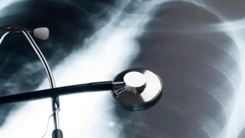 Выросло число больных пневмонией в Нур-Султане