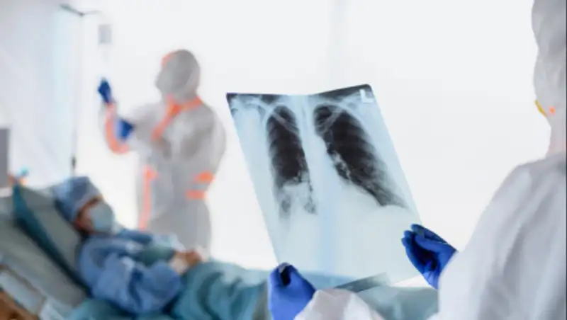 Еще 1102 случая и 17 смертей от коронавирусной пневмонии в РК