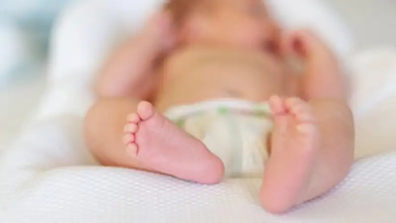 В Индии родился младенец, "беременный" собственным братом