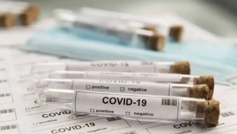 Цены на ПЦР-тесты снизили в Казахстане в два раза