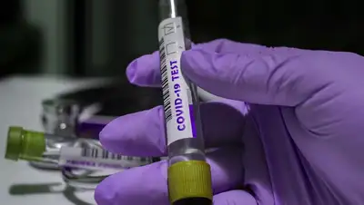 коронавирус, заболевшие , фото - Новости Zakon.kz от 23.05.2022 10:07