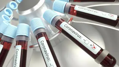 unsplash.com, фото - Новости Zakon.kz от 18.04.2020 17:27