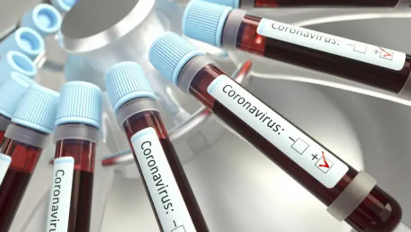 Число заболевших коронавирусом в Казахстане возросло до 1 615