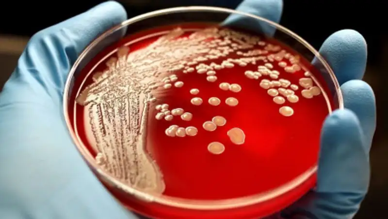 Эксперты объяснили, что такое сибирская язва