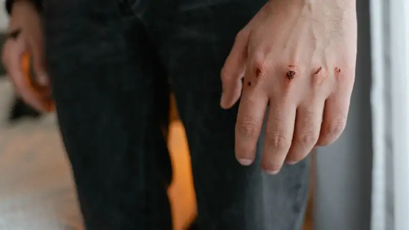 Акмолинец на почве ревности жестоко избил соперника