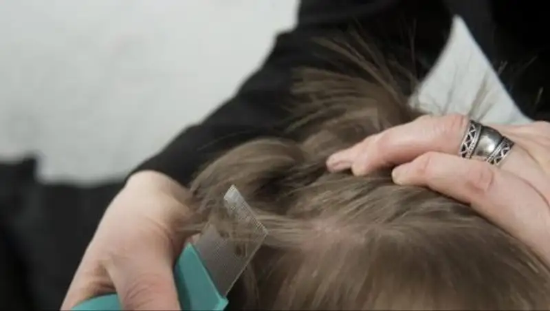 Попытка вывести вшей пестицидом убила ребенка в Алматинской области