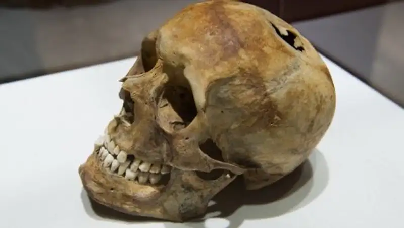 Шахтинскіде иттер адамның бас сүйегін тауып алды